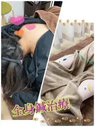 【新規限定】【4月限定価格】🌸全身鍼（慢性痛・女性特有の悩み）（＋500円で箱灸追加可能✨）