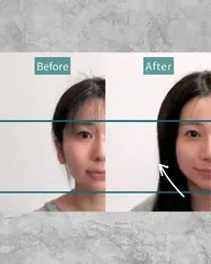 よもぎの力でお顔スッキリ!小顔矯正×おキュウ×微痛小顔コルギ→70分