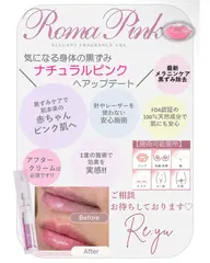 RomaPink(ローマピンク)相談
