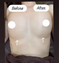 光バストアップ♡ふっくらバストへ🥧