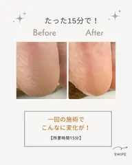 ふわふわかかとケア🦶✨