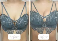 写真モニター価格◆人気No.1【本気の育乳サイズアップ】上半身&育乳マッサージ+豊胸マシーン