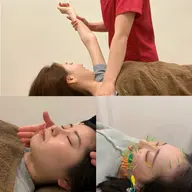 美容鍼（百華鍼）+整体+矯正メニュー