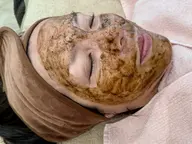 国産ハーブピーリング🌿剥離なし