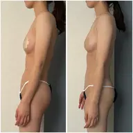 【1日2名限定】　🌻痩せながらバストアップが叶うコース🌻