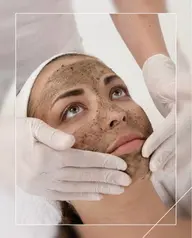 モデル価格‼️50%OFF【剥離有り】ハーブピーリング🌿