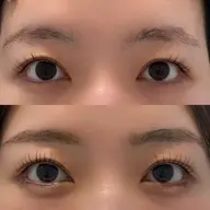 美眉スタイリング+ワックス脱毛