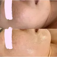 美肌フェイシャル💆‍♀️１名様限定✨８月１０日（土）午前中♡