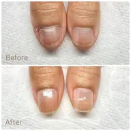 地爪育成お試しメニュー6600円→5500円(体験メニュー)