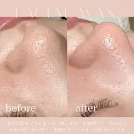 HBL（美眉スタイリング）＋フェイスワックス