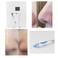 【吸引×導入×炭酸ガスパックでザラつき駆逐】うるつや毛穴洗浄全顔70分