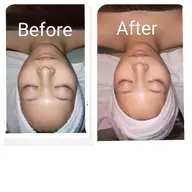 美肌SPAトリートメント