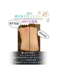 アロマオイルトリートメント90分【全身の疲労回復 | むくみケア】