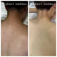 【背中美人】うなじ×背中上部WAX【天然マツヤニ】