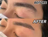 【20代×11/4限定】メンズ眉毛脱毛☆施術写真動画SNS掲載OK＆自己処理後2週経っている方
