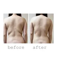 【モニター様限定】選べる箇所セルライトケア！＋マッサージ付きで即効果実感まずはお試し30分2000円📍