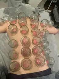 カッピング 30分