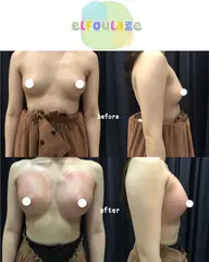 【☘️キャンペーンベーシックバスト☘️】大好評につきベーシックコース❣️￥23,100→￥2,800