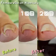 フットケアモニター募集　施術時間1時間ほど、カウンセリング・根本原因説明含め全体時間は110分くらい。宇都宮市