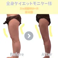 【太ももに隙間を】太もものぼこぼこにアプローチ！60分5,000円