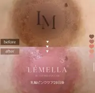 【5月6日限定】今話題のルメラ🩷バストトップマッサージ付き