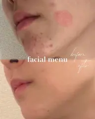 【無料体験】毛穴ごっそり体験🧘🏼