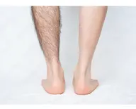 【メンズ脱毛🌈 】あし脱毛(太もも~ふくらはぎ~足の甲指)🙆‍♂️通常9800円→初回6,600円