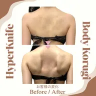 《ミニモ学割》U24  デコルテ＆肩甲骨ケア｜ハイパーナイフ×コルギ｜