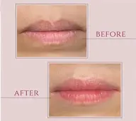 新メニュー🩷静岡県東部初🩷あのメラニン色素ケア導入しました💞ヴィーナスピンクでふわつや【ピンクリップケア】