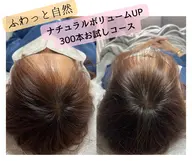 \お試し体験/前髪、分け目ぼかし体験!増毛エクステ300本