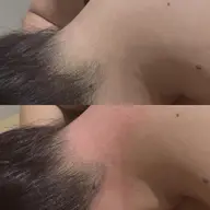 【女性】 すぐ予約限定! うなじワック&うなじ光脱毛