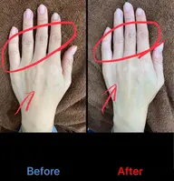 【🤚年齢が出やすい手✋】シワやたるみ気になっていませんか？？指脱毛＋ハンドエステで若々しい手に✨　　ハンドパック付き