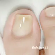 巻き爪対応ジェル(フットケア付き)2本