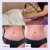 【夏までに痩せたい方必見‼️期間限定モニター】💎遠赤外線マット×ラジオ波×キャビテーション痩身💎（90分）