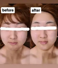 併用可☆小顔フェイシャル60分6000→5800