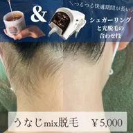 後ろ姿美人✨うなじシュガーリング×最新式光脱毛の合わせ技！mix脱毛でつるつる長持ち👶💓デザイン込み