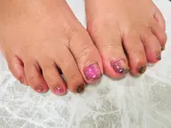 フット角質除去