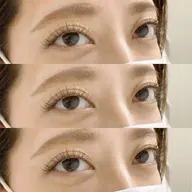 シングルラッシュ100本