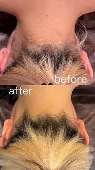 全身脱毛(顔、VIO込み) | 一般価格¥16,500