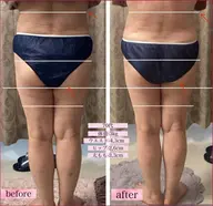 【無料カウンセリング0円】エステで効果が不安な方。初めてエステの方。メニューでお悩みの方へ🌝