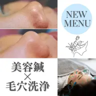 毛穴づまり👃スッキリコース🫧小顔美容鍼+毛穴洗浄