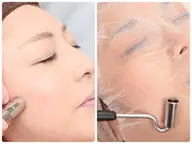 【フェイシャル】ダイヤモンド美肌再生ケア