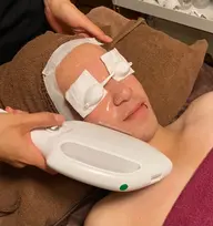 メンズ　お試し髭脱毛(頬から下)