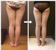 【むくみ撃退/美脚バキュームマッサージ 】やみつきメニューでテレビ登場❤️下半身30分プラン❤️オプションあります✨✨