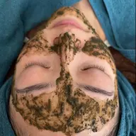 本気の根本肌改善🔥TIPハーブピーリング 1.5g 〚剥離あり〛¥19,800→¥16,500 ※men’s 可