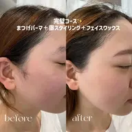 27日13時以降限定☆フェイシャルワックス