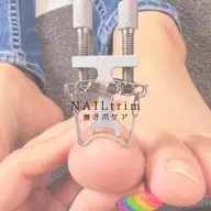 巻き爪、トラブル爪カウンセリング(nailtrim)
