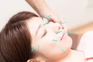 ♢美容はり60分コース♢小顔になりたい方、お肌もちもちになりたい方おすすめ❤