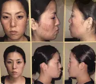 フォトシミケアー通常16500円