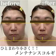 ✨🌷リフトアップ小顔マッサージ🌷✨【小顔コルギ＋ボディコルギ　60分】たるみ/ほうれい線/肩こり/首こり/肩甲骨